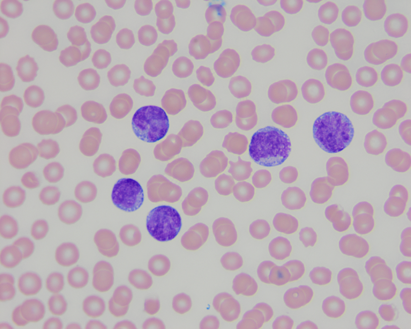 K9 red cell top